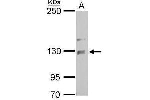 WB Image NCKAP1 antibody [C1C2], Internal detects NCKAP1 protein by Western blot analysis. (NCKAP1 anticorps)