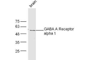 Mouse brain lysates probed with Rabbit Anti-GABA A Receptor alpha 1 Polyclonal Antibody, Unconjugated  at 1:500 for 90 min at 37˚C.
