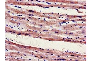 Immunohistochemistry of paraffin-embedded human heart tissue using ABIN7152948 at dilution of 1:100 (FILIP1 anticorps  (AA 957-1192))