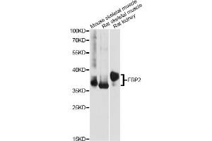Western blot analysis of extracts of various cell lines, using FBP2 antibody (ABIN6292080) at 1:1000 dilution. (FBP2 anticorps)