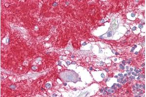 Immunohistochemistry with Brain, cerebellum tissue at an antibody concentration of 5µg/ml using anti-GNAO1 antibody (ARP55425_P050)