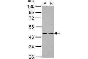 WB Image Sample (30 ug of whole cell lysate) A: H1299 B: HCT116 10% SDS PAGE antibody diluted at 1:1000 (PDCD2 anticorps)