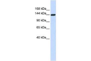 DAAM1 antibody used at 1 ug/ml to detect target protein. (DAAM1 anticorps  (Middle Region))