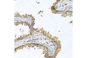 Immunohistochemistry of paraffin-embedded human prostate using RNASE11 antibody (ABIN5970447) at dilution of 1/100 (40x lens). (RNASE11 anticorps)