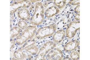 Immunohistochemistry of paraffin-embedded Rat kidney using RNF166 Polyclonal Antibody (RNF166 anticorps)