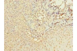 Immunohistochemistry of paraffin-embedded human tonsil tissue using ABIN7142924 at dilution of 1:100 (ABI3 anticorps  (AA 1-366))