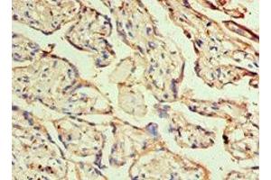 Immunohistochemistry of paraffin-embedded human placenta tissue using ABIN7155678 at dilution of 1:100 (DLX3 anticorps  (AA 1-120))
