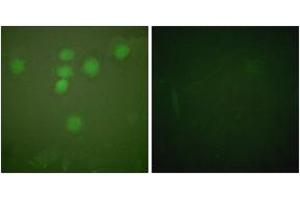 Immunofluorescence analysis of HeLa cells, using CREB (Ab-142) Antibody. (CREB1 anticorps  (AA 111-160))