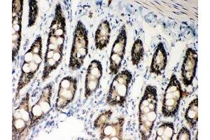 IHC-P: MSH2 antibody testing of rat intestine tissue (MSH2 anticorps  (AA 337-583))