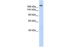 DYSF antibody used at 1 ug/ml to detect target protein. (Dysferlin anticorps)