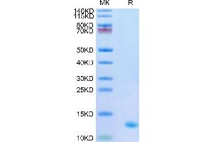 Human CXCL4 on Tris-Bis PAGE under reduced condition.