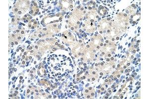 Cytokeratin 17 antibody was used for immunohistochemistry at a concentration of 4-8 ug/ml to stain Epithelial cells of renal tubule (arrows) in Human Kidney.