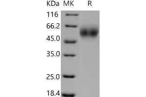 Western Blotting (WB) image for CD200 Receptor 1 (CD200R1) (Active) protein (His tag) (ABIN7320364) (CD200R1 Protein (His tag))