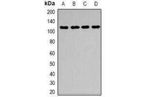 Western blot analysis of Desmoglein 1 expression in HEK293T (A), mouse kidney (B), mouse brain (C), mouse lung (D) whole cell lysates. (Desmoglein 1 anticorps  (N-Term))