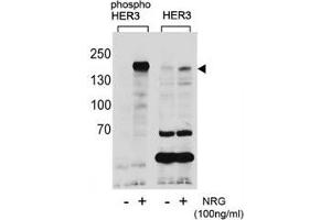 Western blot analysis of extracts from T47D cells, untreated or treated with NRG, using phospho-HER3 antibody (left) or nonphos Ab (right). (ERBB3 anticorps  (pTyr1289))