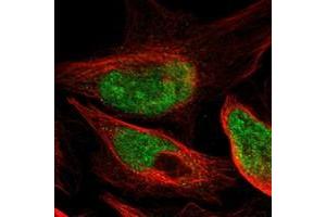 Immunofluorescent staining of human cell line U-2 OS with DACH1 polyclonal antibody  at 1-4 ug/mL dilution shows positivity in nucleus, nucleoli.