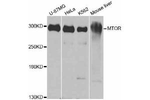 Western blot analysis of extracts of various cell lines, using MTOR antibody.
