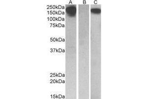 HEK293 lysate (10ug protein in RIPA buffer) overexpressing Human CSF1R with C-terminal MYC tag probed with AP22413PU-N(0. (CSF1R anticorps  (Internal Region))