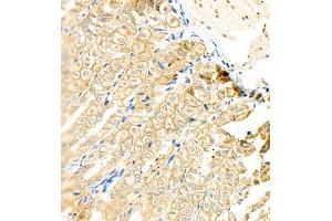 Immunohistochemistry of paraffin embedded mouse stomach using CK13 (ABIN7074411) at dilution of 1:1200 (400x lens) (Cytokeratin 13 anticorps  (C-Term))