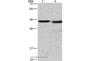 Western blot analysis of Mouse kidney tissue and A172 cell, using CTSL Polyclonal Antibody at dilution of 1:900 (Cathepsin L anticorps)