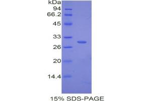 SDS-PAGE analysis of Mouse Complement Factor D Protein. (Adipsin Protéine)