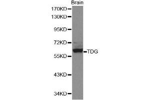 Western blot analysis of extracts of mouse brain, using TDG antibody. (TDG anticorps  (AA 1-160))
