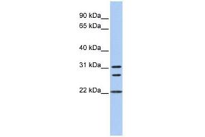 Calponin 1 antibody used at 1 ug/ml to detect target protein.