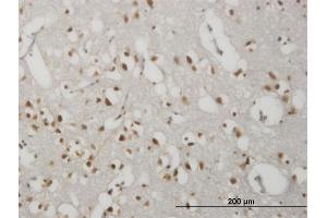 Immunoperoxidase of monoclonal antibody to GPR135 on formalin-fixed paraffin-embedded human cerebral cortex.