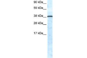 WB Suggested Anti-GFI1 Antibody Titration:  0. (GFI1 anticorps  (N-Term))