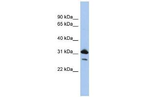 RAP1B antibody used at 1 ug/ml to detect target protein. (RAP1B anticorps  (N-Term))