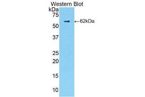 Western Blotting (WB) image for anti-Complement Factor B (CFB) (AA 34-159) antibody (ABIN1858377) (Complement Factor B anticorps  (AA 34-159))