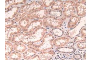 IHC-P analysis of Human Kidney Tissue, with DAB staining. (POR anticorps  (AA 77-518))