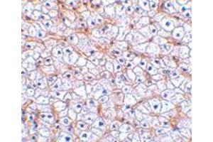 Immunohistochemistry of TNFRSF12A in human liver tissue with TNFRSF12A polyclonal antibody  at 2.