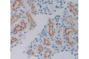 Used in DAB staining on fromalin fixed paraffin- embedded Kidney tissue (SIRPA anticorps  (AA 56-296))