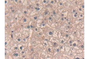 Detection of GHRH in Human Liver Tissue using Polyclonal Antibody to Growth Hormone Releasing Hormone (GHRH)