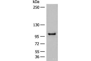 Western blot analysis of HEPG2 cell lysate using CTDP1 Polyclonal Antibody at dilution of 1:500