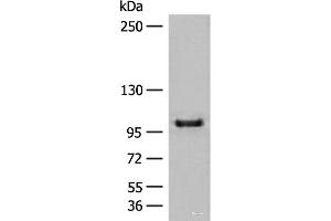 Western blot analysis of HEPG2 cell lysate using CTDP1 Polyclonal Antibody at dilution of 1:500 (CTDP1 anticorps)