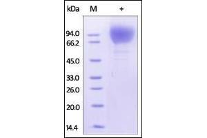 HIV-1 [HIV-1/Clade C (16055)] GP120 on SDS-PAGE under reducing (R) condition.