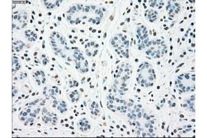 Image no. 1 for anti-Checkpoint Kinase 2 (CHEK2) antibody (ABIN1497496)