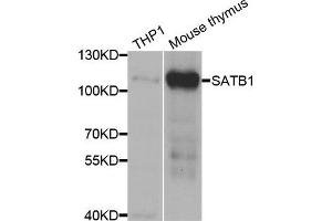 Western blot analysis of extracts of THP1 and mouse thymus cell lines, using SATB1 antibody.