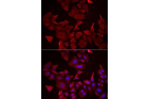 Immunofluorescence analysis of HeLa cells using CASP14 antibody (ABIN5973925). (CASP14 anticorps)