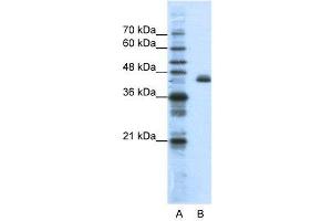WB Suggested Anti-ZFP36L2  Antibody Titration: 1.