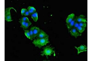 Immunofluorescent analysis of MCF-7 cells using ABIN7144346 at dilution of 1:100 and Alexa Fluor 488-congugated AffiniPure Goat Anti-Rabbit IgG(H+L)