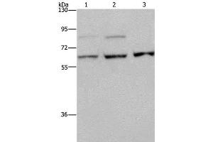 Western Blot analysis of A431, MCF-7 and Hela cell using KIF22 Polyclonal Antibody at dilution of 1:200 (KIF22 anticorps)