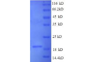 SDS-PAGE (SDS) image for Integrin alpha V (ITGAV) (AA 891-1048) protein (His tag) (ABIN5713570)