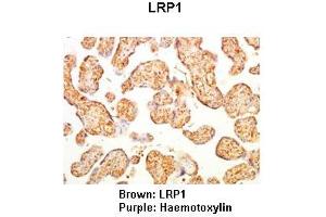 Lanes: Human placenta Primary Antibody Dilution: 1:500Secondary Antibody: Anti-rabbit-HRP Secondary Antibody Dilution: 1:0000  Gene Name: Brown: LRP1 Purple: Haemotoxylin Submitted by: LRP1