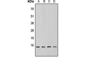 Western blot analysis of 4EBP1 (pT69) expression in HEK293T (A), NS-1 (B), H9C2 (C), rat liver (D) whole cell lysates. (eIF4EBP1 anticorps  (pSer69))