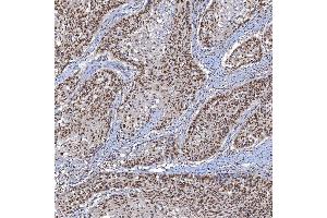 IHC analysis of TRMT61A using anti-TRMT61A antibody (ABIN7599220). (TRMT61A anticorps  (AA 1-289))