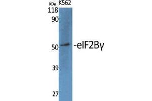 Western Blot (WB) analysis of specific cells using eIF2Bgamma Polyclonal Antibody. (EIF2B3 anticorps  (Internal Region))