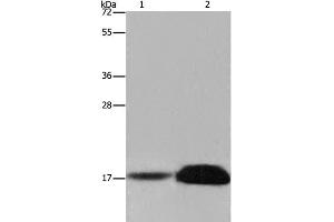 Western Blot analysis of Mouse kidney and Human kidney tissue using FHIT Polyclonal Antibody at dilution of 1:600 (FHIT anticorps)